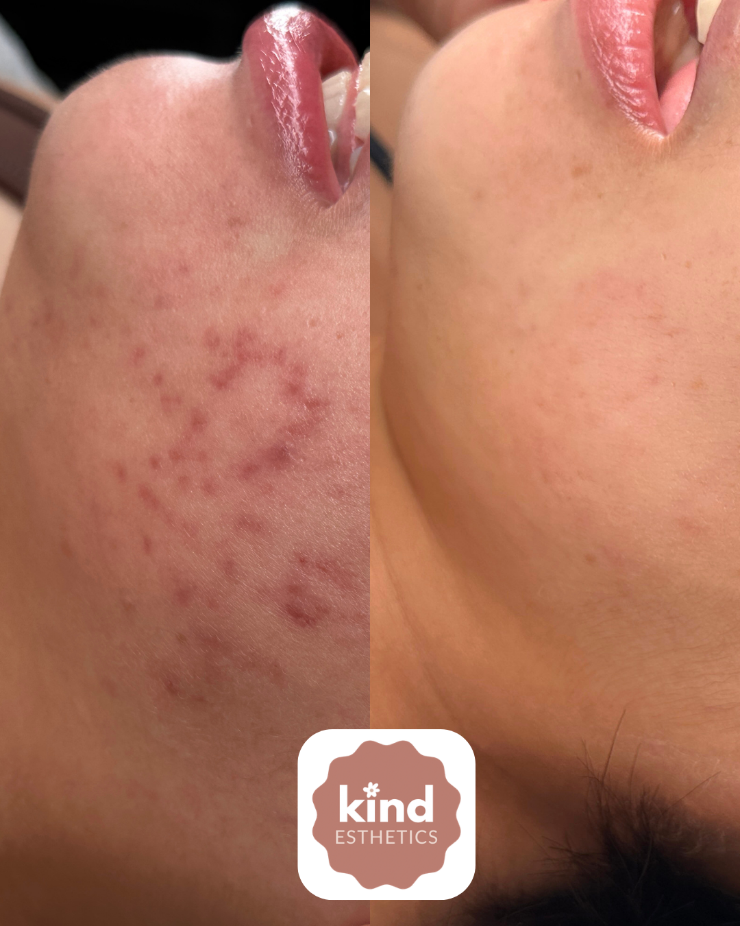 Kind Esthetics Skin Shop