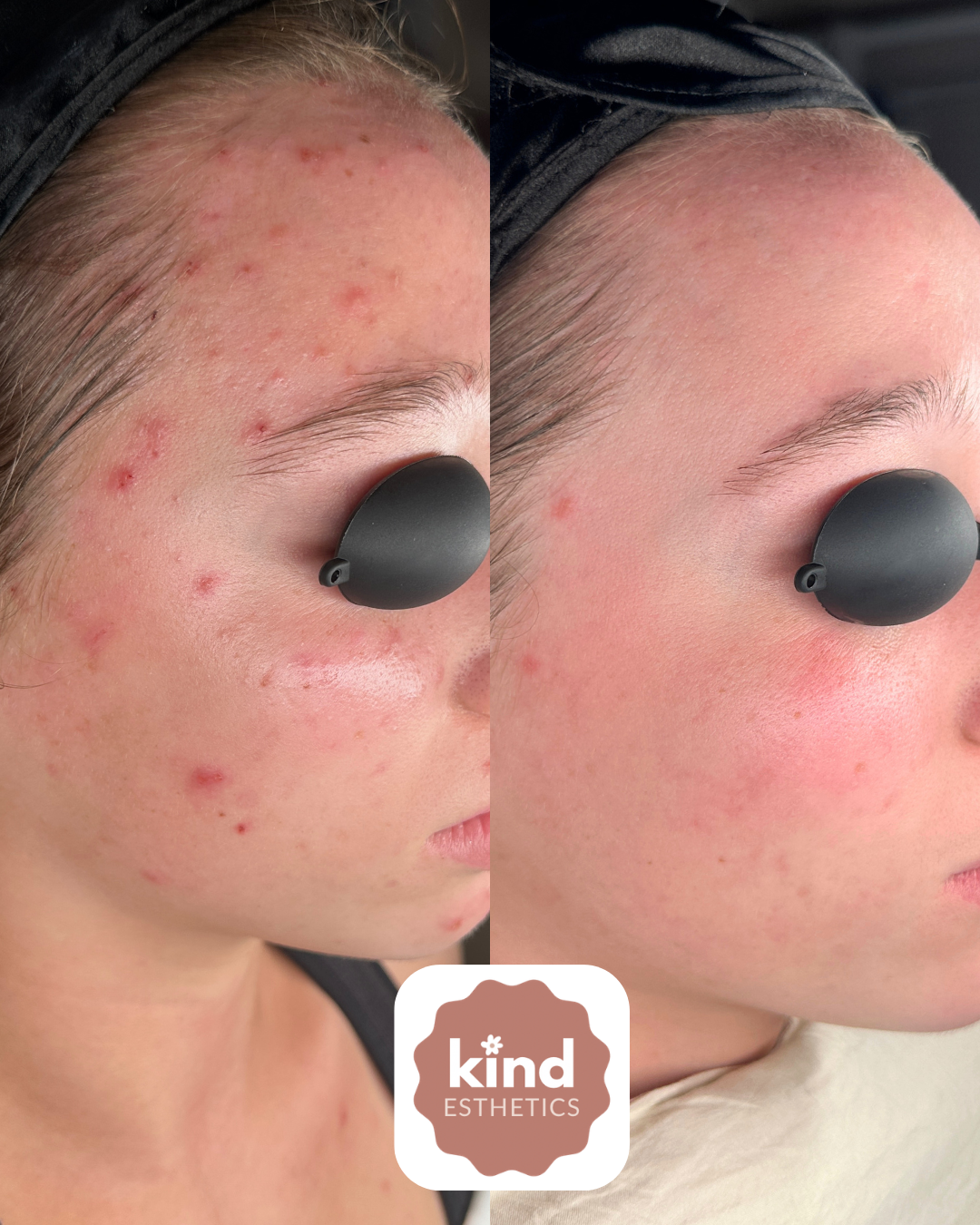 Kind Esthetics Skin Shop