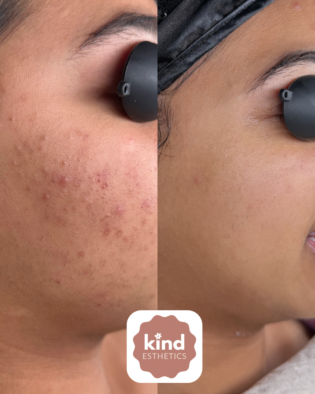 Kind Esthetics Skin Shop