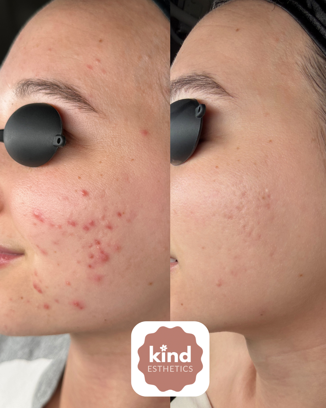 Kind Esthetics Skin Shop