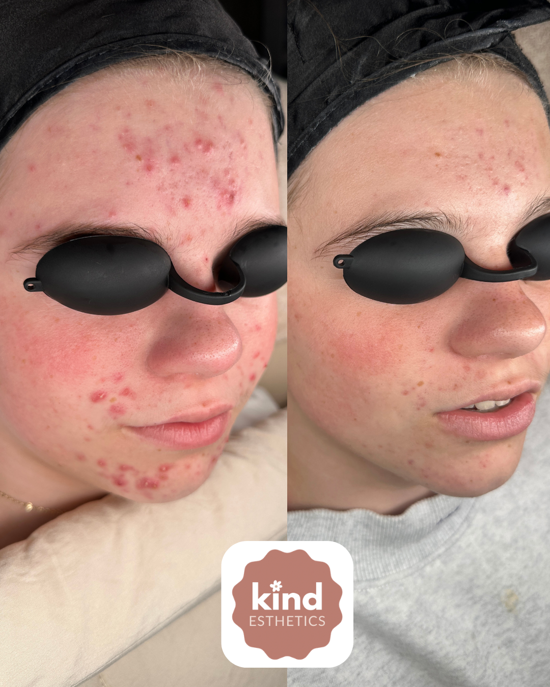 Kind Esthetics Skin Shop
