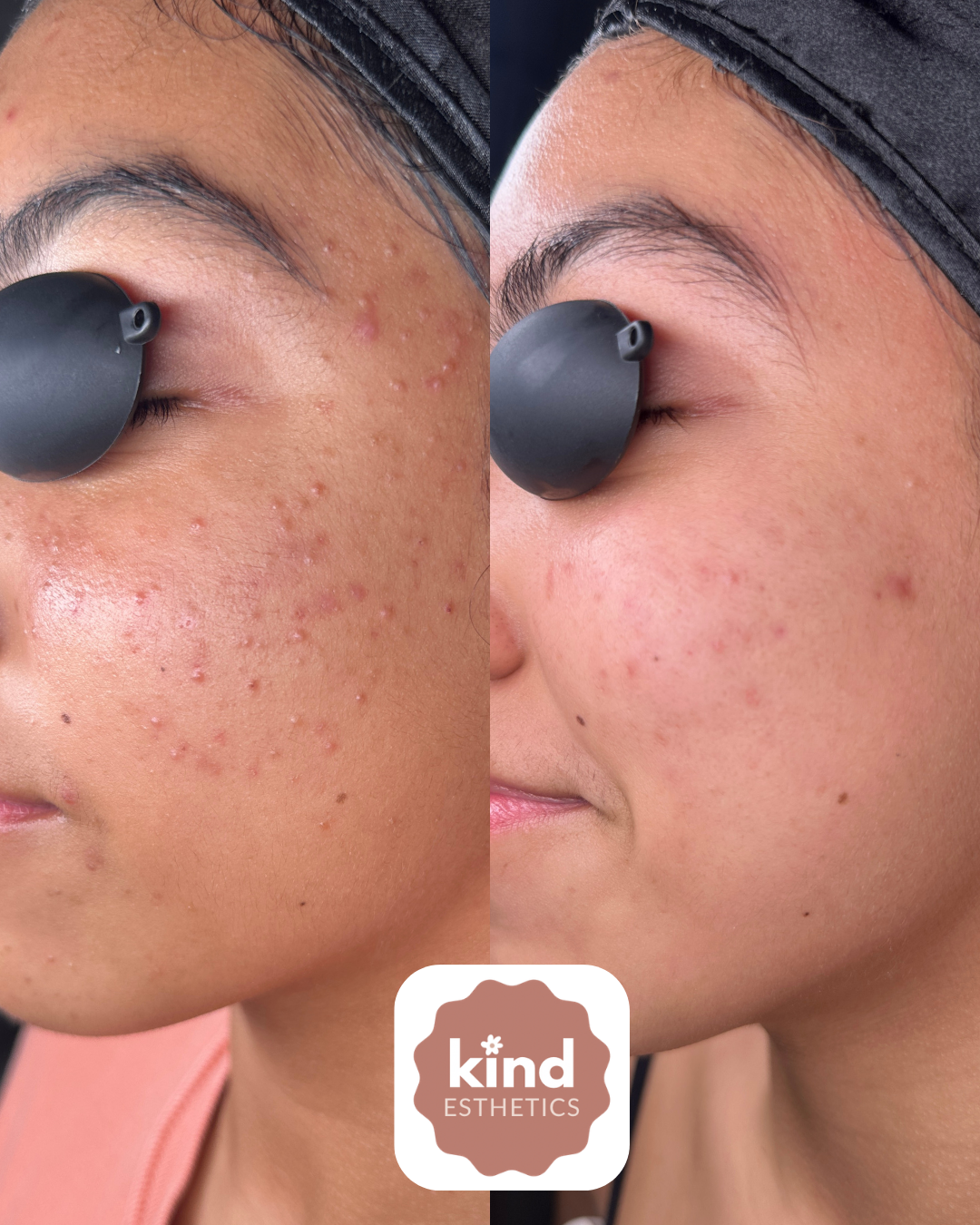 Kind Esthetics Skin Shop
