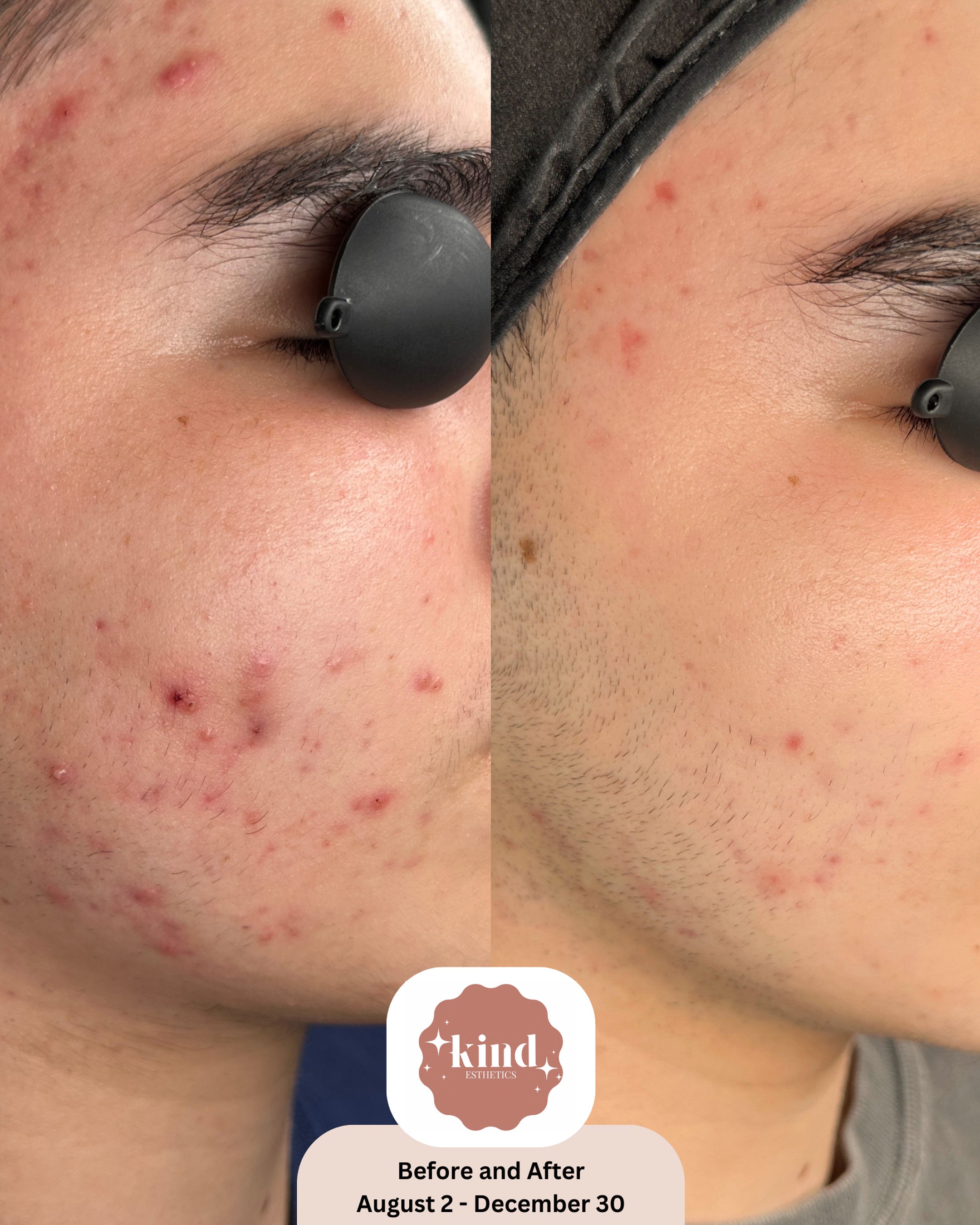 Kind Esthetics Skin Shop