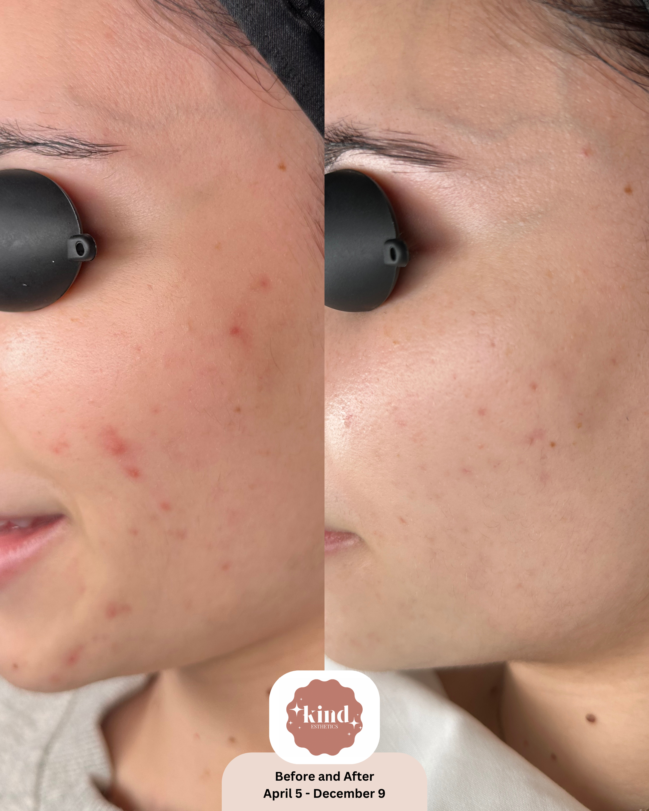 Kind Esthetics Skin Shop