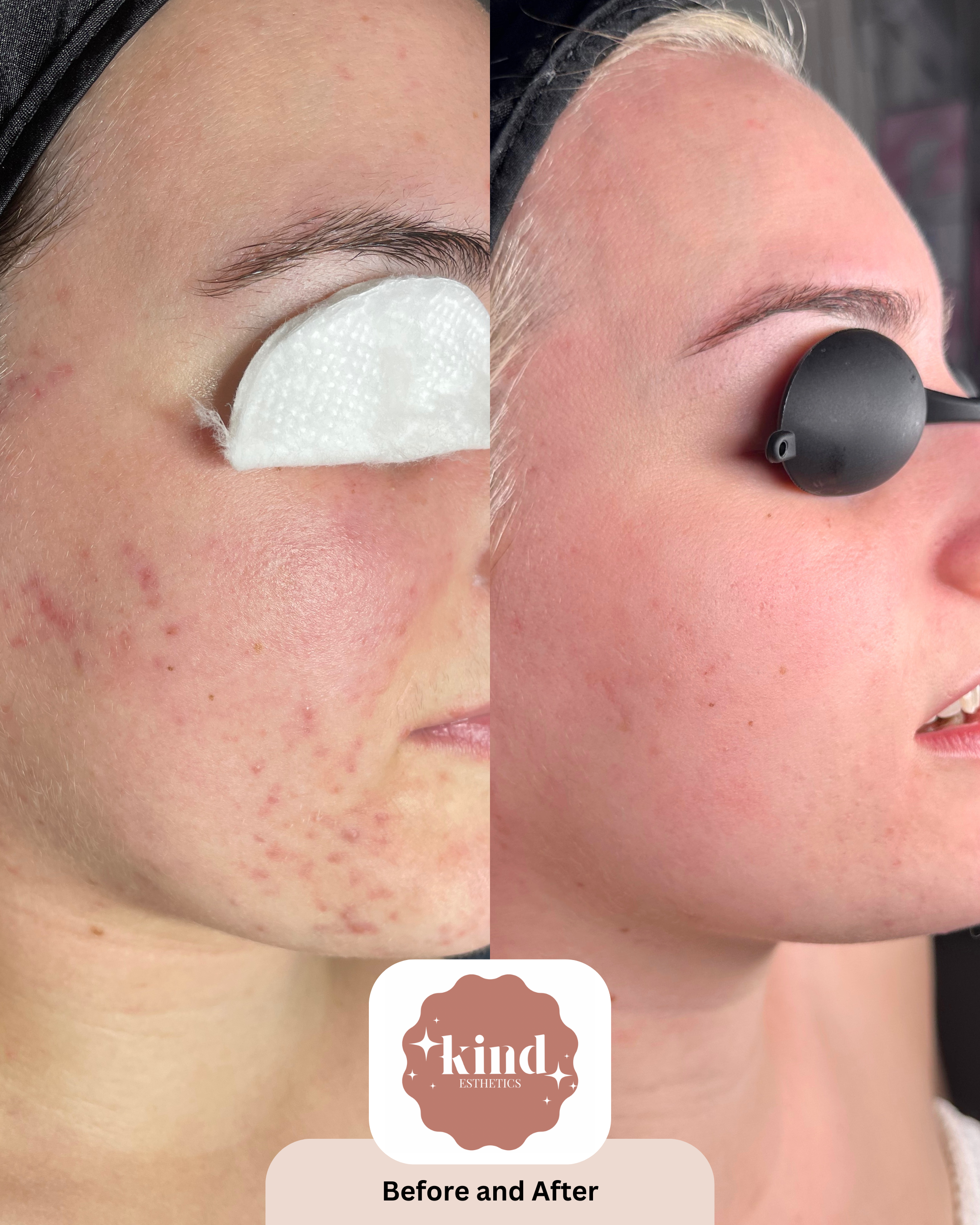 Kind Esthetics Skin Shop