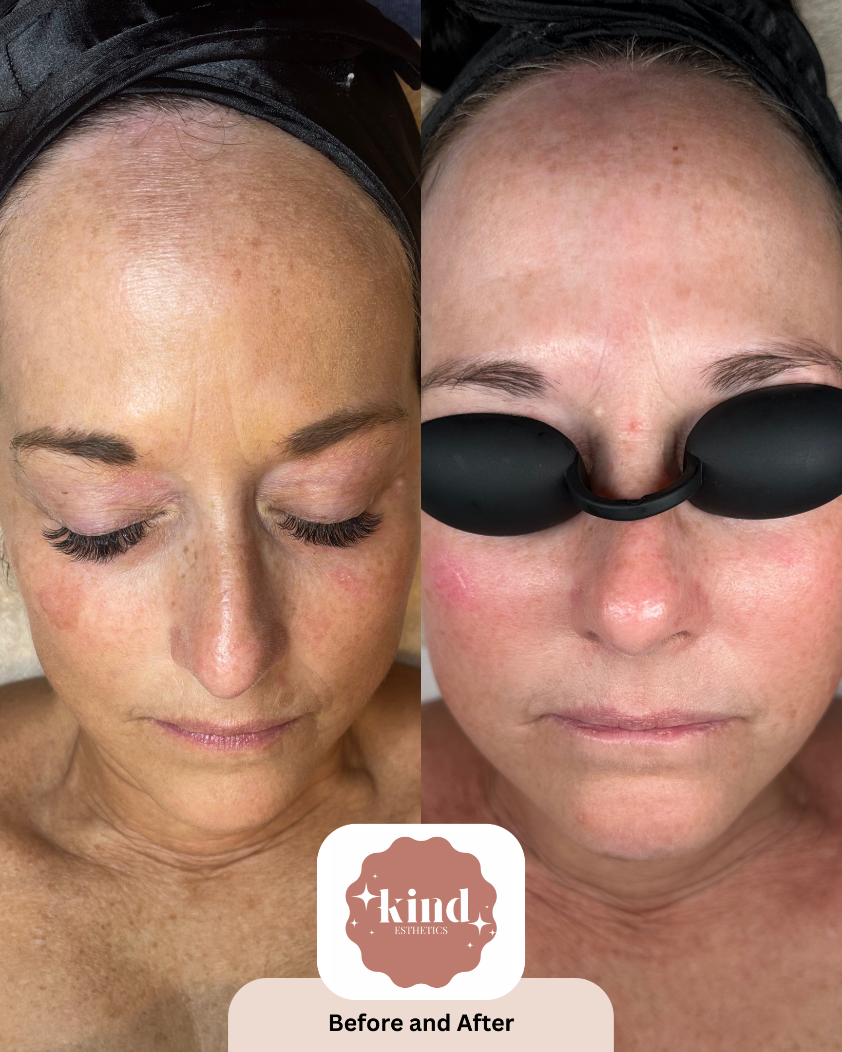 Kind Esthetics Skin Shop