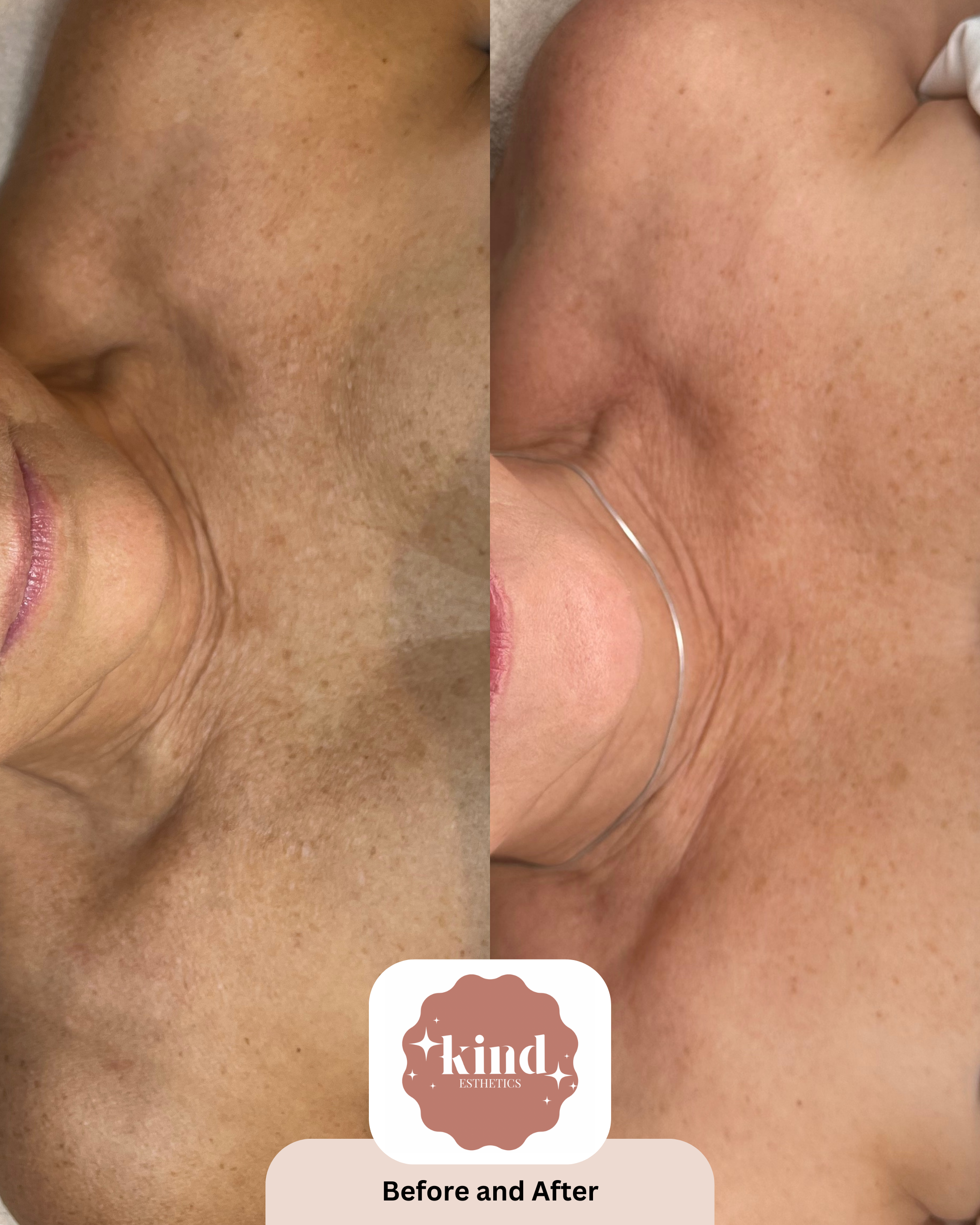 Kind Esthetics Skin Shop